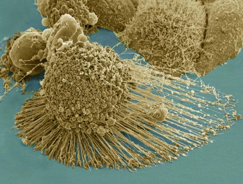 HeLa cell, self-destructing.